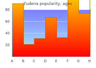 purchase discount zudena line