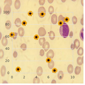 Sacral agenesis