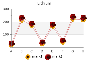 buy cheapest lithium and lithium