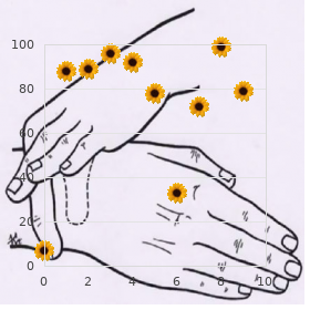 Cantu Sanchez Corona Fragoso syndrome