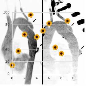 Tutuncuoglu syndrome