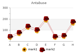 buy 250 mg antabuse with amex