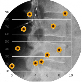 Parainfluenza virus type 3 antenatal infection