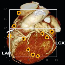 Mucopolysaccharidosis