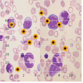 Omodysplasia type 1