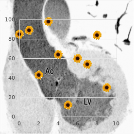 Acute lymphoblastic leukemia congenital sporadic aniridia