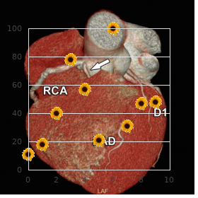 Radio renal syndrome