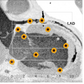 Brachycephaly deafness cataract mental retardation