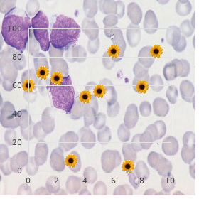 Winter Harding Hyde syndrome