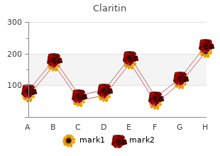 claritin 10mg free shipping