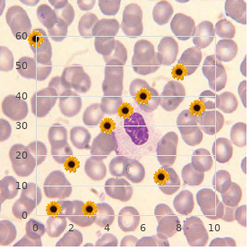 Chromhidrosis