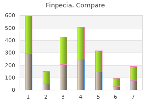 buy finpecia 1mg free shipping