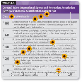 Malignant hyperthermia susceptibility type 5