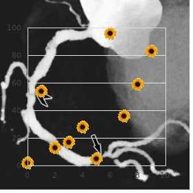 Hypertrichosis brachydactyly obesity and mental retardation