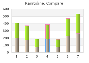 discount 300 mg ranitidine