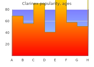 buy cheapest clarinex