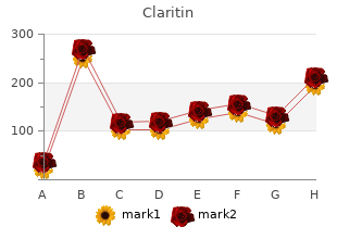 discount claritin uk