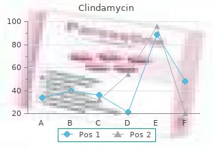 150 mg clindamycin otc