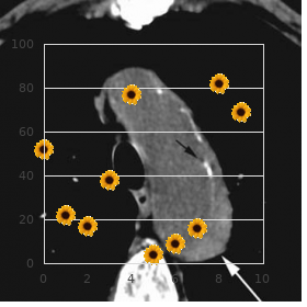 Pancreatic carcinoma, familial
