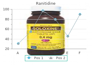 150 mg ranitidine fast delivery