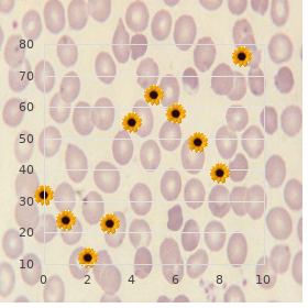 Vein of Galen aneurysmal malformationss (VGAM)