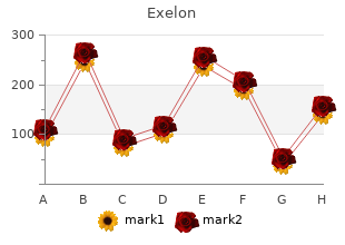 buy 3 mg exelon with mastercard