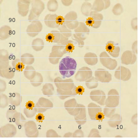 Dihydropyrimidine dehydrogenase deficiency