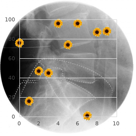 Midline defects autosomal type