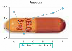 order 1 mg finpecia visa