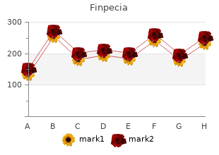 cheap 1mg finpecia free shipping