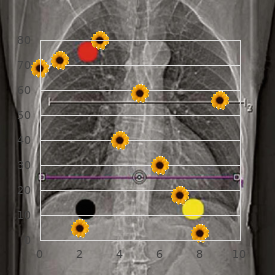 Chudley Mccullough syndrome