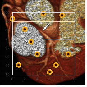 Interstitial pneumonia