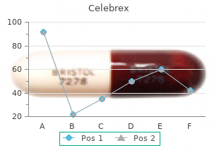 order celebrex pills in toronto