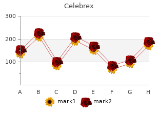 buy celebrex with amex