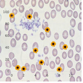 Cholestatic jaundice renal tubular insufficiency