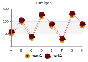 buy lumigan with amex