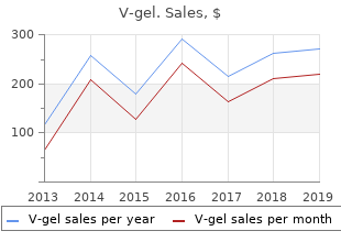 purchase v-gel amex