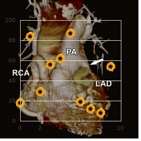 Morquio disease, type A