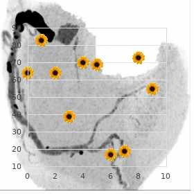 Periventricular laminar heterotopia