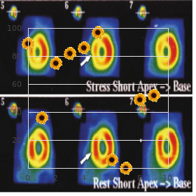 Abdallat Davis Farrage syndrome