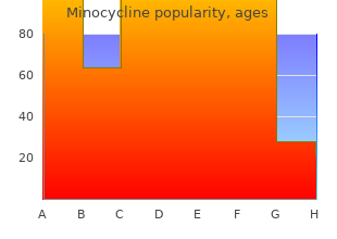 generic minocycline 50 mg amex