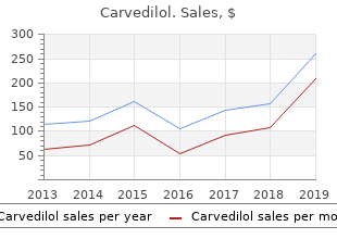 order generic carvedilol on line