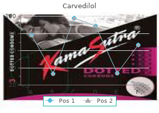 cheapest carvedilol