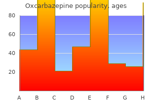 buy oxcarbazepine on line amex