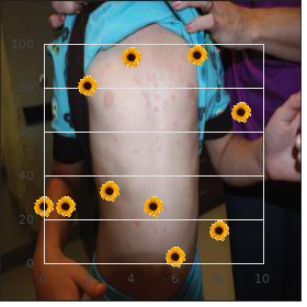 Albinism immunodeficiency