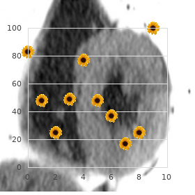 Steatocystoma multiplex