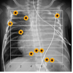 Myocardium disorder