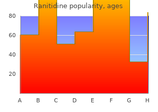 generic ranitidine 150mg without a prescription