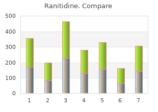 generic ranitidine 150 mg on line