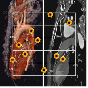 Rigid spine syndrome